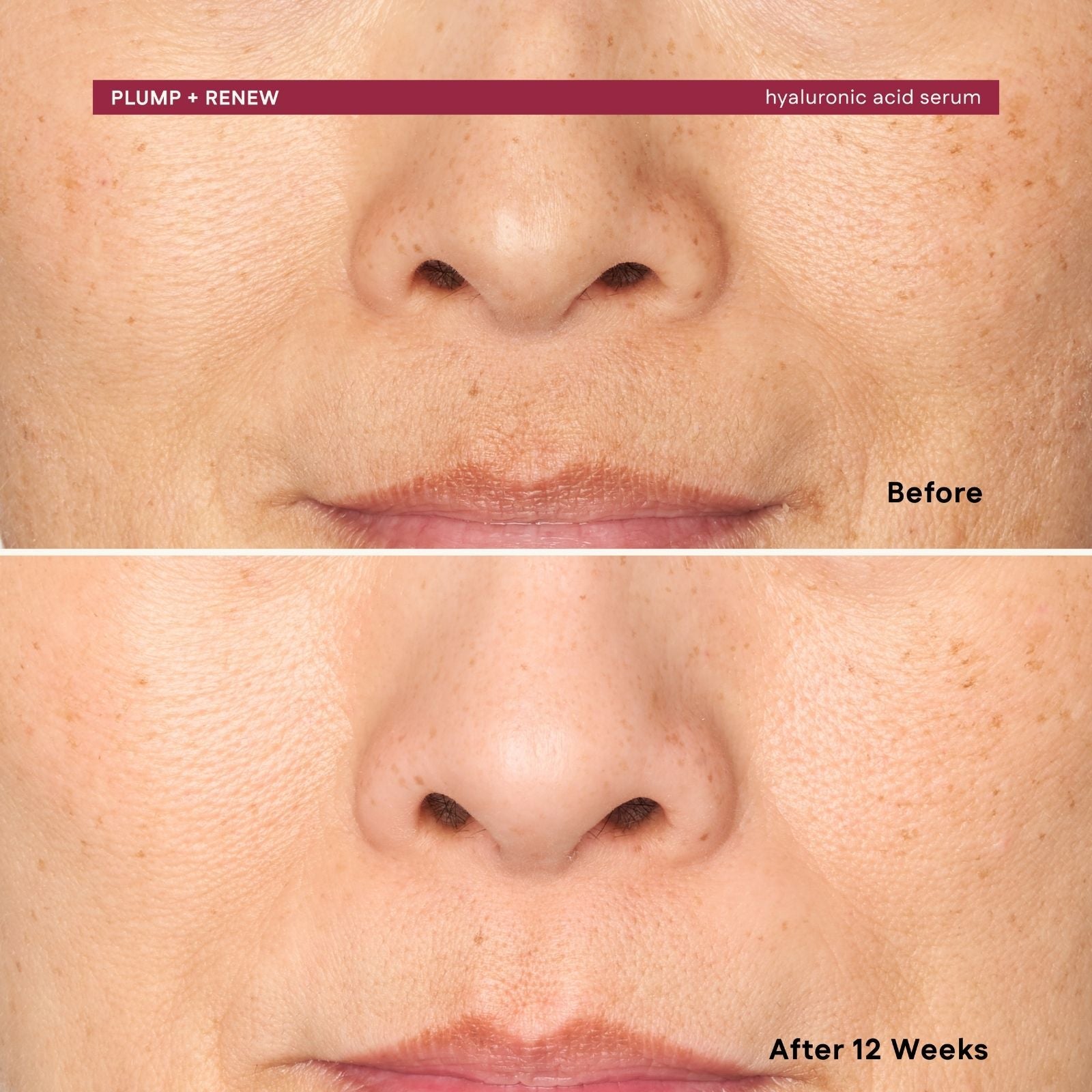 Before and after comparison of a person's lips with 'Plump + Renew' hyaluronic acid serum applied.