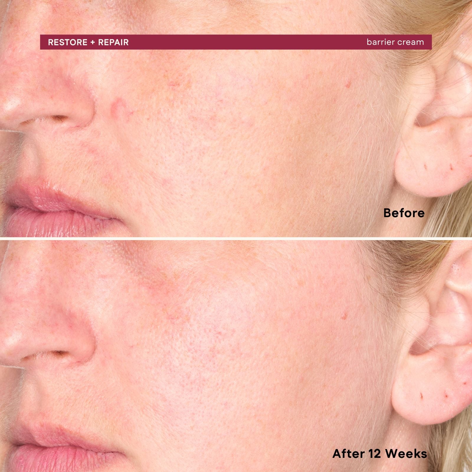 Before and after comparison of a woman's face with visible, labeled 'Restore & Repair Barrier Cream'.