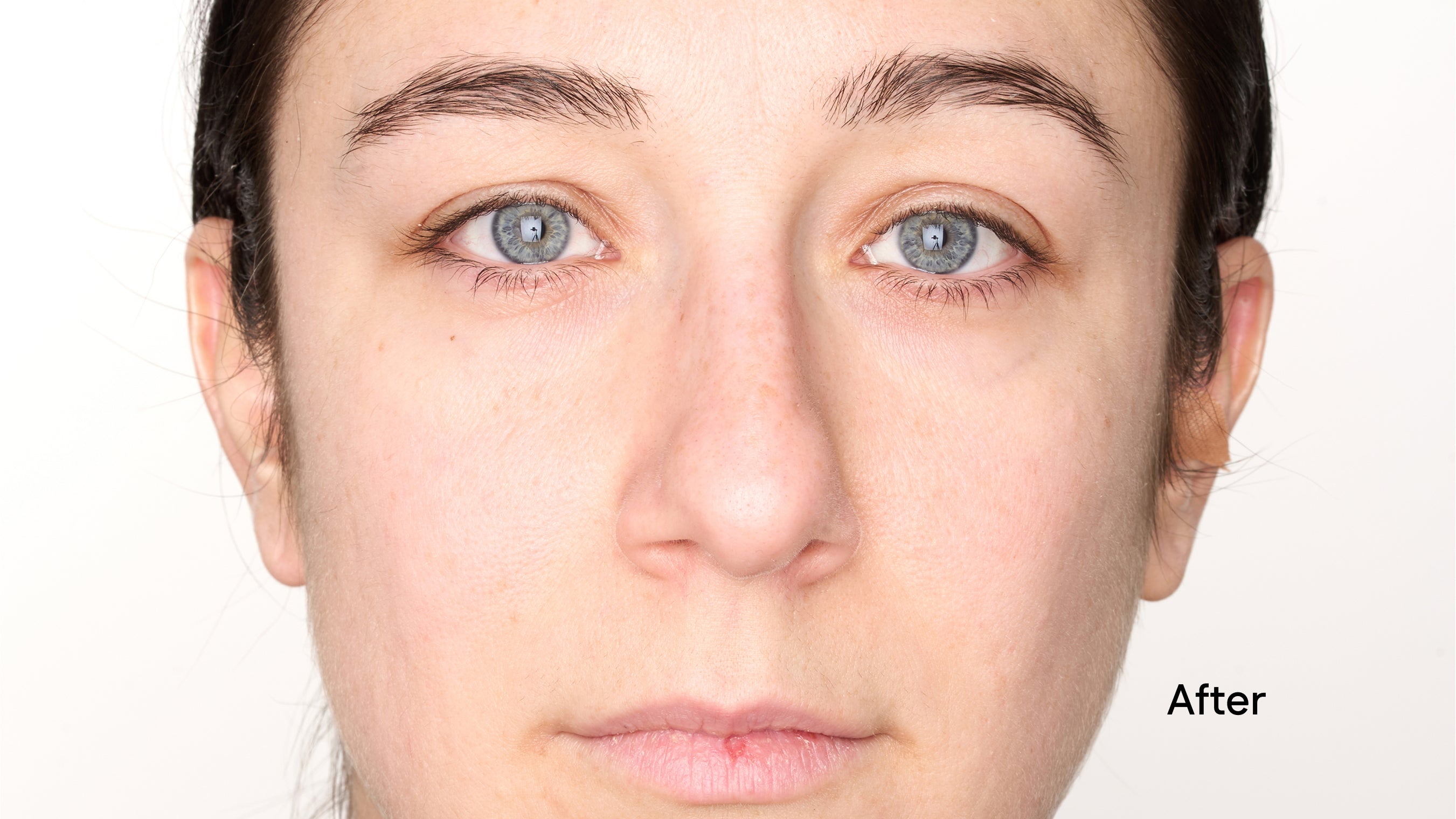 Before and after comparison of a person's face with 'After' label.