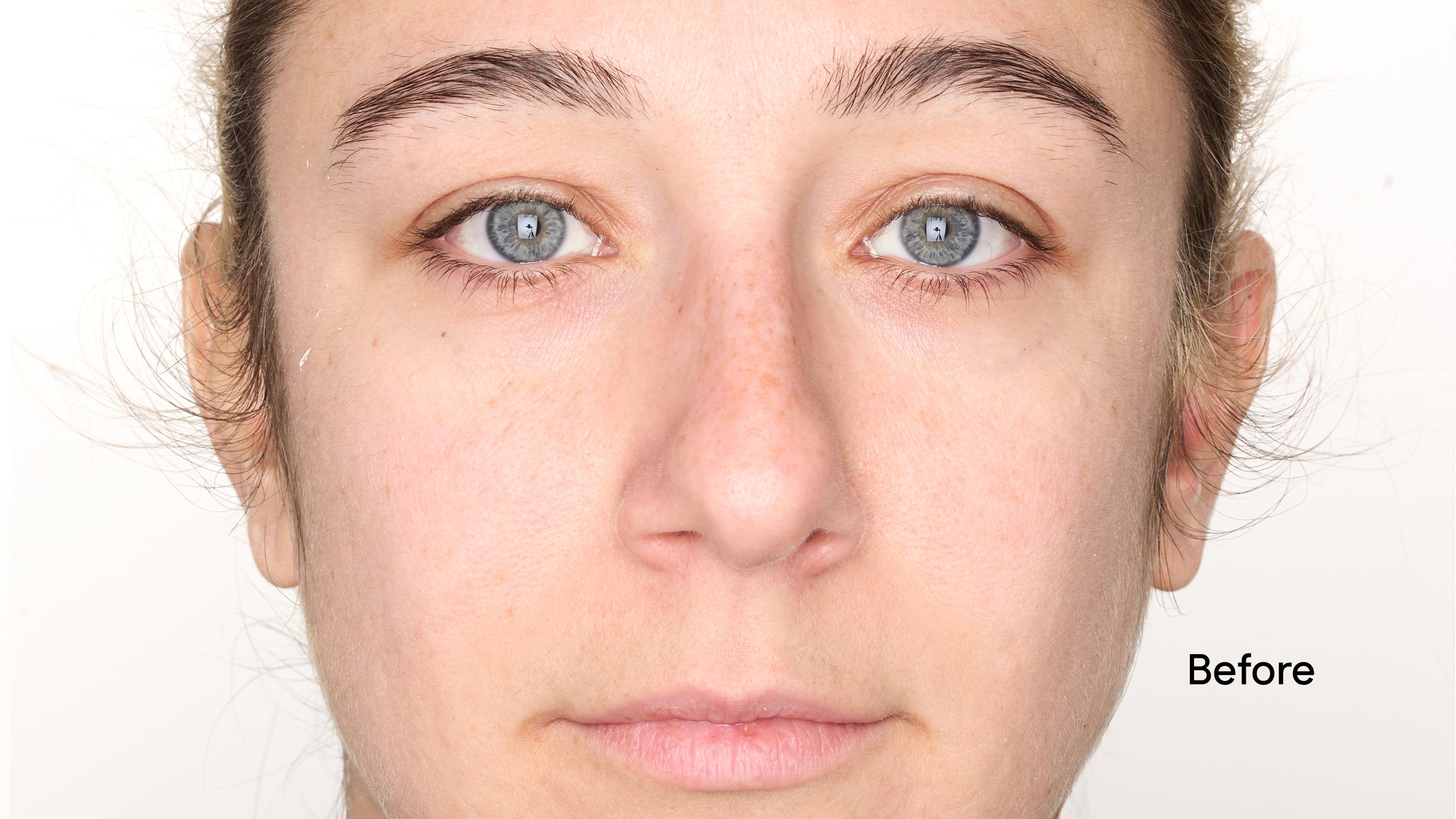 Close-up of a person's face with 'Before' label on a white background