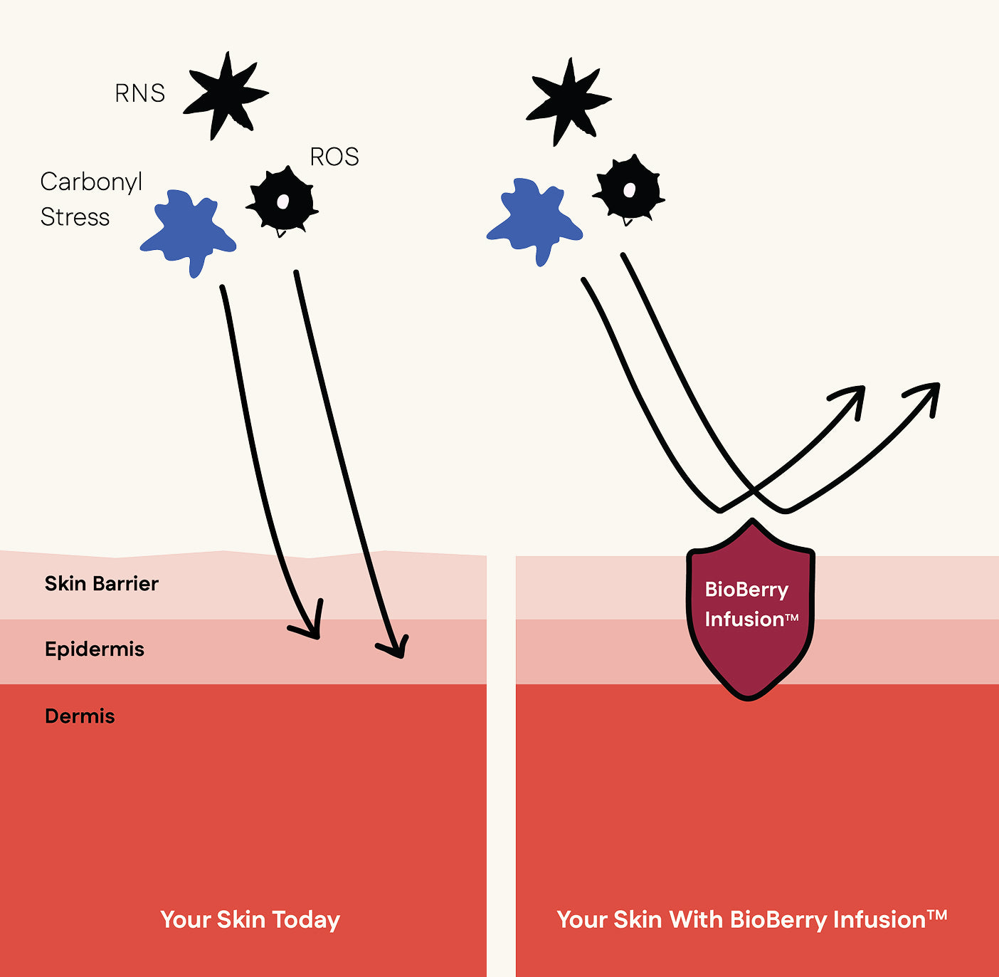 Diagram showing skin barrier with BioBerry Infusion and its effects on skin health.